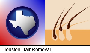 Houston, Texas - an epilation concept diagram